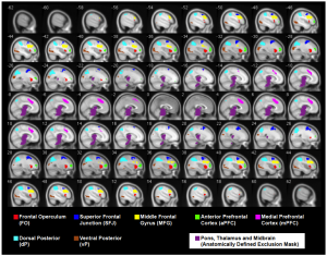 MS_fMRI