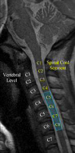 Data from the first event-related spinal cord fMRI experiment (Figley and Stroman, 2012).