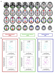 Intrinsic brain connectivity vs. body composition (Figley et al., SfN 2013).